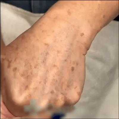 💜©︎[Official Store] Fubsta® EPIGLOW MelanEX premium cream against hyperpigmentation | ✅Complies with US high standard cosmetic regulations