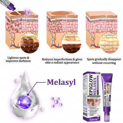 💜©︎[Official Store] Fubsta® EPIGLOW MelanEX premium cream against hyperpigmentation | ✅Complies with US high standard cosmetic regulations