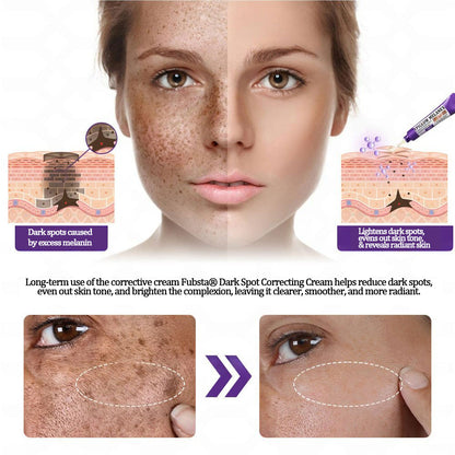 💜©︎[Official Store] Fubsta® EPIGLOW MelanEX premium cream against hyperpigmentation | ✅Complies with US high standard cosmetic regulations